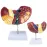 1:1 Human Pathological Liver Anatomical Model - Digestive System Anatomy Teaching Tool [Liver Model, Anatomy Display]