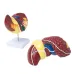 1:1 Human Pathological Liver Anatomical Model - Digestive System Anatomy Teaching Tool [Liver Model, Anatomy Display]