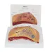 1:1 Human Female Breast Pathology Anatomy Model Kit - Detailed Table-Type Breast Lesion Model for Medical Education