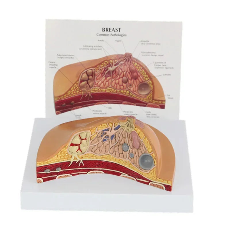 1:1 Human Female Breast Pathology Anatomy Model Kit - Detailed Table-Type Breast Lesion Model for Medical Education