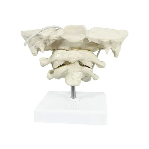1.5X Enlarged Human Cervical Spine Model with Occipital Bone - Medical Teaching Aid