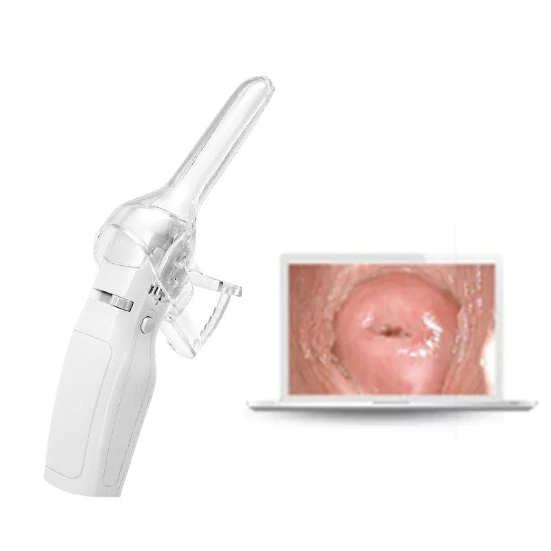 FA2 Portable Digital Video Mini Colposcope for Self-Exam & Gynecological Health Monitoring [Mini Colposcope, Self-Exam, Gynecological Health]