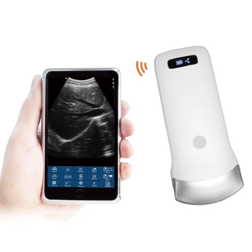 Wireless Ultrasound Probe - Portable WIFI Scanner with Convex/Linear Probes, 3.5Mhz/7.5Mhz, ISO & Android Support
