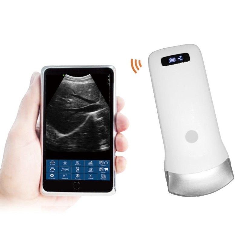 Wireless Ultrasound Probe - Portable WIFI Scanner with Convex/Linear Probes, 3.5Mhz/7.5Mhz, ISO & Android Support