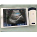 Wireless Ultrasound Probe CProbe-5C - Portable WIFI Scanner with Color Doppler, 3.2Mhz/5Mhz, Android/iOS Support