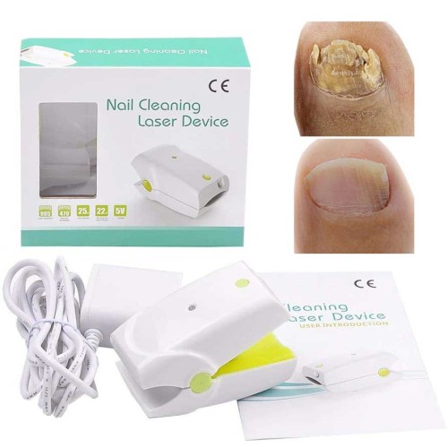 Urządzenie laserowe do leczenia grzybicy paznokci - rewolucyjne domowe urządzenie do usuwania grzybicy paznokci | Szybkie, bezbolesne leczenie