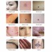 8-Level Electronic Tattoo Mole Removal Plasma Pen - Laser Freckle, Dark Spot, Wart Remover for Face & Skin Care