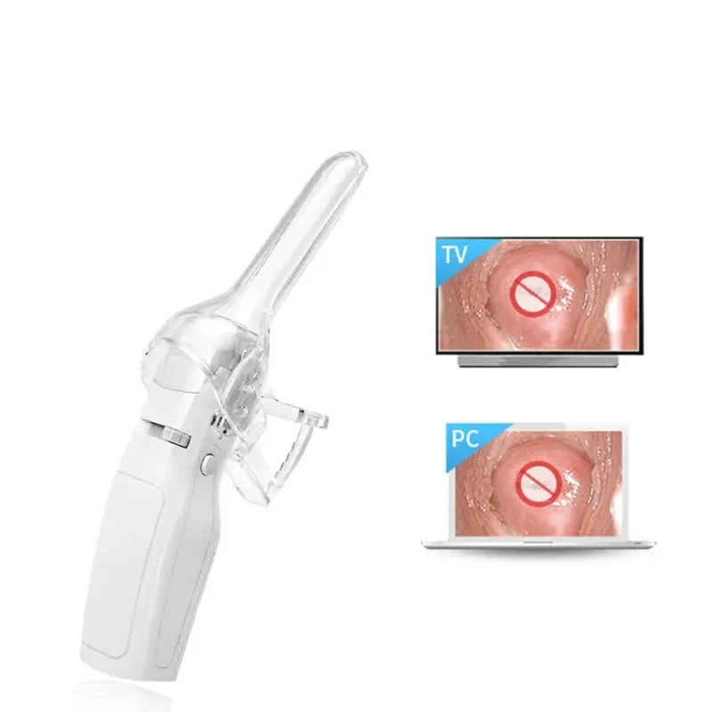FA2 Portable Digital Video Electronic Mini Colposcope for Women's Cervix & Vagina Self-Exam [Gynecological Health, Self-Care]
