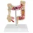 Anatomical Human Colorectal Lesion Model - Detailed Colon Disease Anatomy for Medical Teaching & Learning