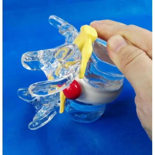 Anatomical Lumbar Vertebrae Model - Degenerative Disc Herniation & Spine Anatomy Demonstration [Medical Education, Spine Model]
