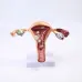 Anatomical Pathological Uterus Ovary Model - Life Size Female Reproductive System Study Tool [Medical, Anatomy, Cross Section]
