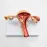 Anatomical Pathological Uterus Ovary Model - Life Size Female Reproductive System Study Tool [Medical, Anatomy, Cross Section]