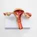 Anatomical Pathological Uterus Ovary Model - Life Size Female Reproductive System Study Tool [Medical, Anatomy, Cross Section]
