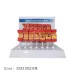 Arterial Vessel Atherosclerosis Model - Middle-Aged & Elderly Blood Vessel Structure for Medical Education [PVC, 25X15X21CM]