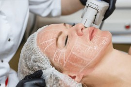 HIFU Machine: The Ultimate Guide to the Revolutionary Non-Surgical Facelift