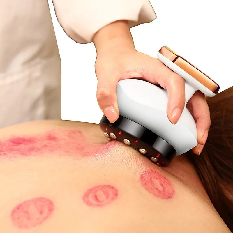 Body Shaper Slimming Massager - Vacuum Suction Cups for Anti-Cellulite, Fat Burning, and Physiotherapy [Slimming, Massager, Vacuum Suction]