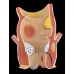 Anatomical Human Rectum Pathology Model - Hemorrhoids, Anus Lesions, Medical Teaching Supplies [PVC, 12x12x19cm]