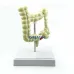 Colorectal Lesion Model - Human Colon Anatomy Pathological Diseases Model for Medical Education [Colon Model, Pathology, Medical Anatomy]