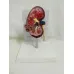 Dog Kidney Anatomical Model - Healthy & Morbid Canine Kidney for Veterinary Teaching & Pet Health Education [Veterinary Model, Dog Kidney Anatomy]
