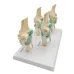 Four-Stage Human Pathological Knee Joint Anatomy Model - Medical Teaching Tool [Knee Anatomy, Pathology Model]