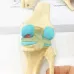 Four-Stage Human Pathological Knee Joint Anatomy Model - Medical Teaching Tool [Knee Anatomy, Pathology Model]
