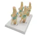 Four-Stage Human Pathological Knee Joint Anatomy Model - Medical Teaching Tool [Knee Anatomy, Pathology Model]