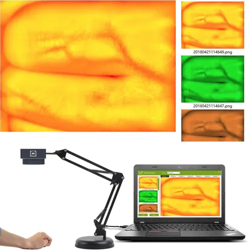 HD 2MP Adjustable Vein Viewer with Infrared LED, USB Camera for IV & Medical Vein Finder [Infrared Imaging, Vein Detection]