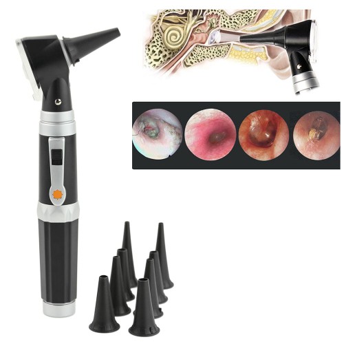 Professional LED Otoscope Kit - Portable Ear Endoscope with 3x Magnification for Medical Diagnosis [Otoscope, Ear Care, LED Light]