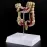 Human Colorectal Lesion Model - Pathological Anatomy Colon Diseases Intestine Medical Teaching Tool [Colorectal Lesion, Medical Teaching]
