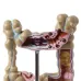 Human Colorectal Lesion Model - Pathological Anatomy Colon Diseases Intestine Medical Teaching Tool [Colorectal Lesion, Medical Teaching]