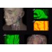 HD Vein Imaging Vein Viewer - Infrared Vein Finder for Medical Professionals [Vein Imaging, Vein Finder]