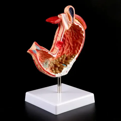 Human Stomach Anatomy Model - 1:1 Lifesize Gastric Pathology Medical Teaching Tool [Stomach Model, Gastric Ulcer, Gastritis]