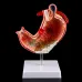 Human Stomach Anatomy Model - 1:1 Lifesize Gastric Pathology Medical Teaching Tool [Stomach Model, Gastric Ulcer, Gastritis]