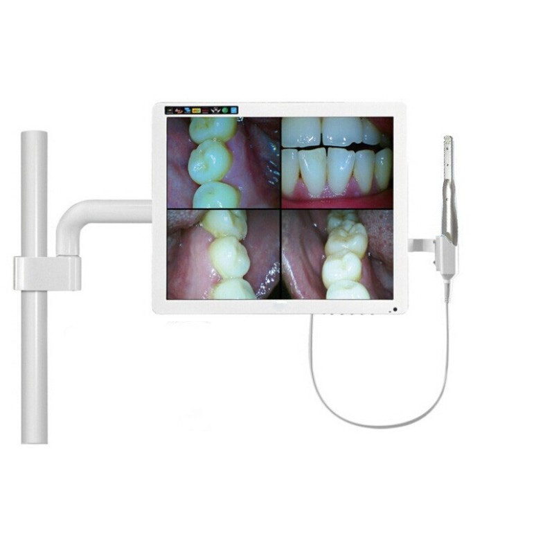 Dental Intraoral Camera USB 2.0, 4MP HD Endoscope with 6-LED, Dynamic Imaging for Dentists & Clinics