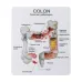 Human Colorectal Lesion Model - Pathological Anatomy Colon Diseases Intestine Medical Teaching Tool [Colorectal Lesion, Medical Teaching]