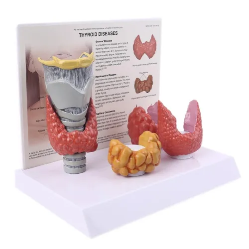 Human Thyroid Gland Model - Life-Size Anatomy Teaching Tool for Medical Study & Pathology Display [Thyroid Model, Anatomy Tool]