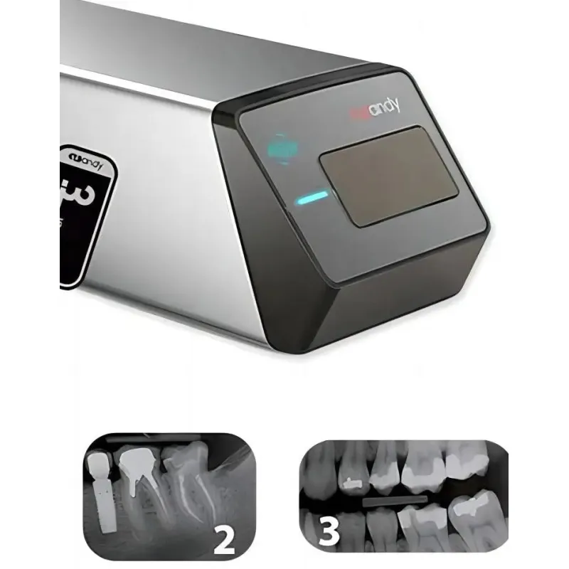 Handy Brand HDS-500 Digital Dental X-Ray Scanner - Compact, Fast Imaging, High-Resolution [Dental Scanner, X-Ray Sensor]