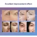 Newface Electric RF Eye Bags Removal & Wrinkle Reduction Beauty Machine for Dark Circles and Eye Massage Treatment
