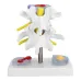 Intervertebral Disc Herniation Model - Lumbar Spine Pathology Teaching Tool for Medical Education [Spine Model, Herniated Disc, Medical Teaching]
