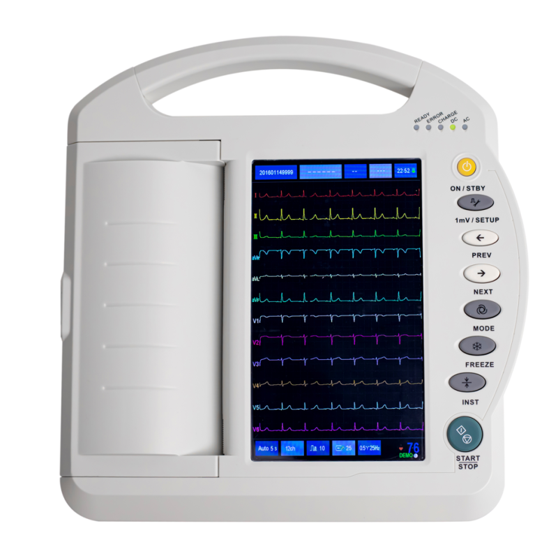 Portable 10-inch 12-Channel ECG Machine MK-1212A with Touchscreen & Wi-Fi Connectivity