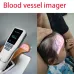 HF-410A Handheld Infrared Vein Viewer - Medical Vein Finder for Clinics & Salons [Infrared Vein Locator, Vein Detection]