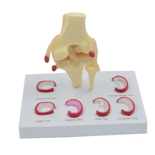 Life Size Meniscus Suture Model - Anatomical Human Demilune Menisci Medical Teaching Tool [Medical Science, Teaching Tool]
