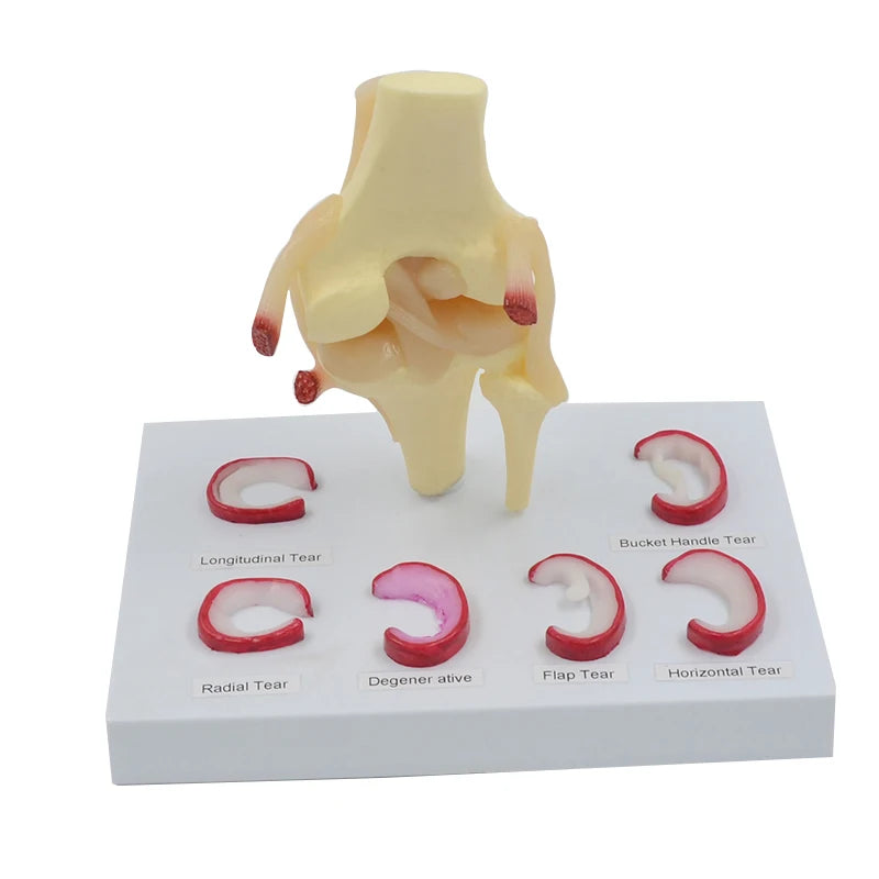 Life Size Meniscus Suture Model - Anatomical Human Demilune Menisci Medical Teaching Tool [Medical Science, Teaching Tool]