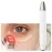 EMS Beauty Device Multi-Function Eye Pen for Dark Circles, Eye Bags, Wrinkle Lifting & Firming | RF Skin Tightening & Red Light Therapy