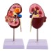 Dog Kidney Anatomical Model - Healthy & Morbid Canine Kidney for Veterinary Teaching & Pet Health Education [Veterinary Model, Dog Kidney Anatomy]