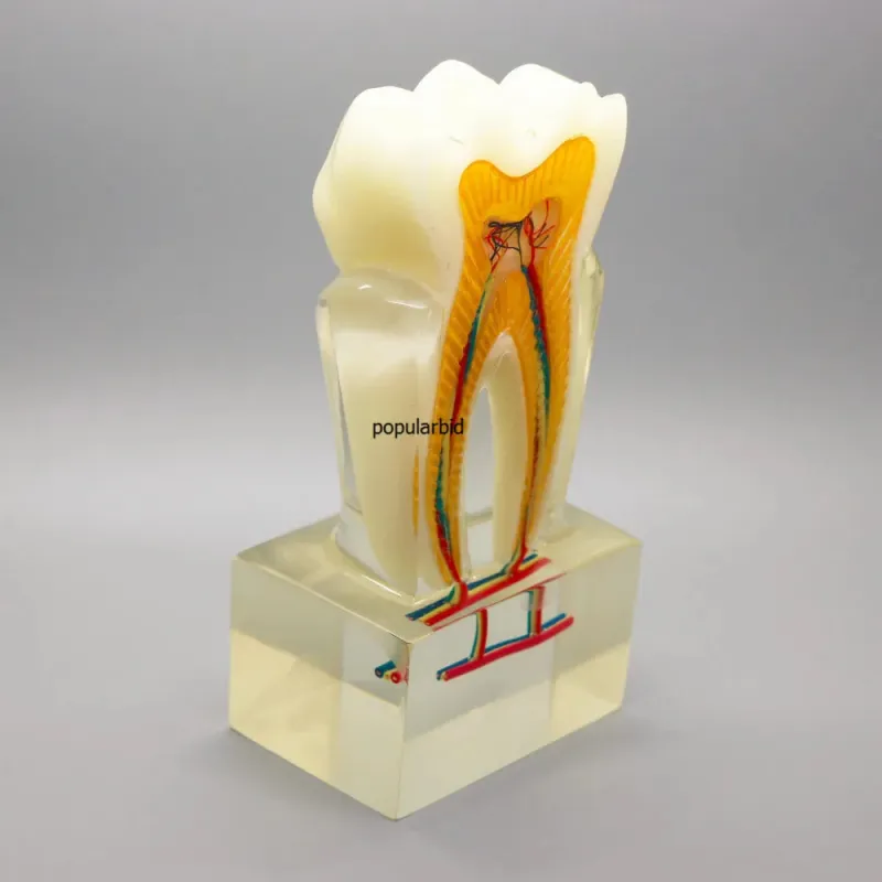 6:1 Orthodontic Teeth Model with Clear Base - Anatomical Molar Dissection for Dentist & Endodontics Teaching [Dental Education, Molar Anatomy]