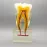 6:1 Orthodontic Teeth Model with Clear Base - Anatomical Molar Dissection for Dentist & Endodontics Teaching [Dental Education, Molar Anatomy]