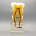 6:1 Orthodontic Teeth Model with Clear Base - Anatomical Molar Dissection for Dentist & Endodontics Teaching [Dental Education, Molar Anatomy]