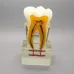 6:1 Orthodontic Teeth Model with Clear Base - Anatomical Molar Dissection for Dentist & Endodontics Teaching [Dental Education, Molar Anatomy]