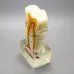 6:1 Orthodontic Teeth Model with Clear Base - Anatomical Molar Dissection for Dentist & Endodontics Teaching [Dental Education, Molar Anatomy]